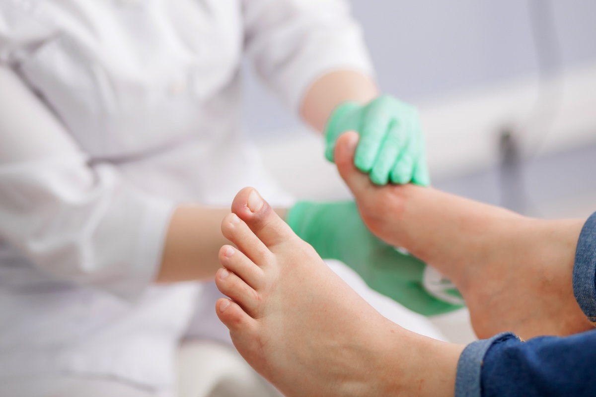 El azúcar en sangre causa mala circulación, afectación de los nervios y entumecimiento lo que, en última instancia, podría provocar la amputación del pie. 
