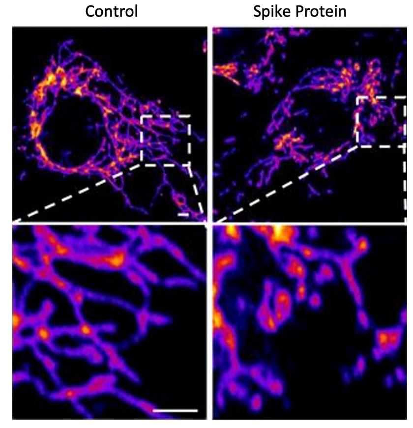 A la izquierda, imágenes de células sanas del endotelio vascular. A la derecha, la exposición a la proteína S produce un aumento de la fragmentación mitocondrial (Instituto Salk).