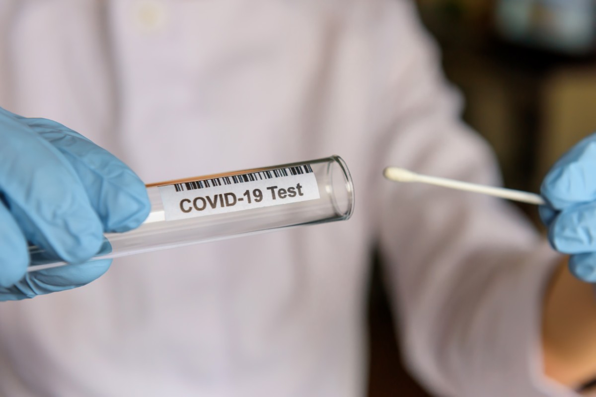 La mayoría de test comercializados evalúan un único tipo de antígeno frente al SARS-CoV-2. 