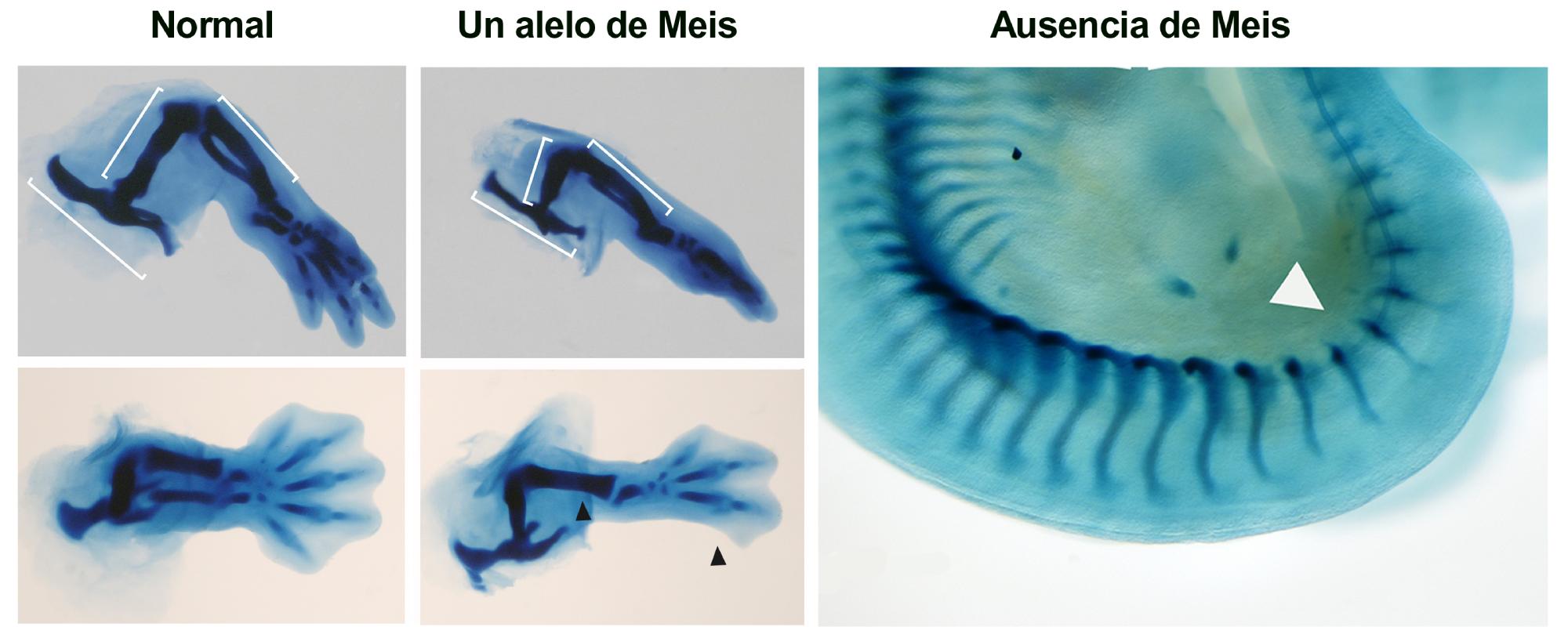 Tinciones esqueléticas de extremidades inferiores en embriones normales, con un alelo o en ausencia total de Meis. Los embriones con una sola copia carecen de peroné y dos dedos posteriores (flechas negras). La ausencia total de Meis resulta en la ausencia de extremidad (flecha blanca).