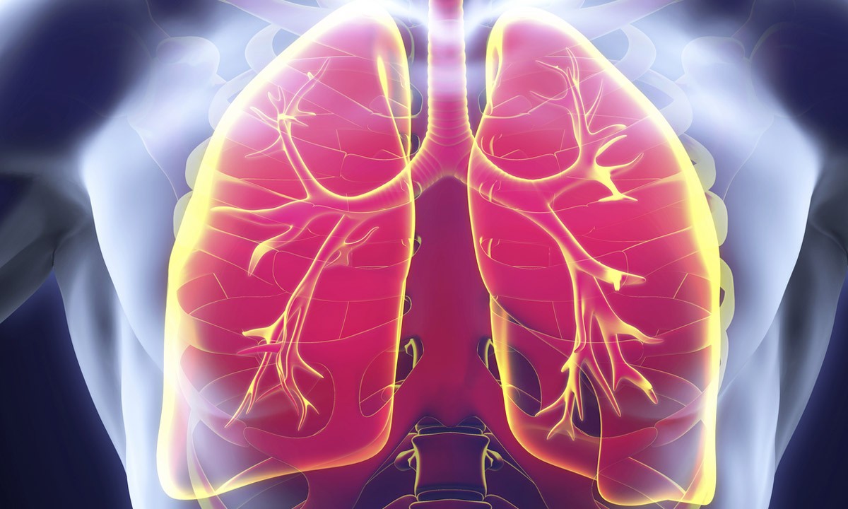 Nuevas técnicas de imagen adelantan la detección de lesiones pulmonares. 