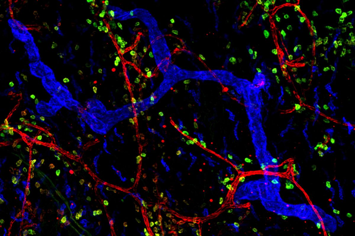 Macrófagos (en azul) presentes en tejido humano. (FOTO: Universidad de Newcastle). 