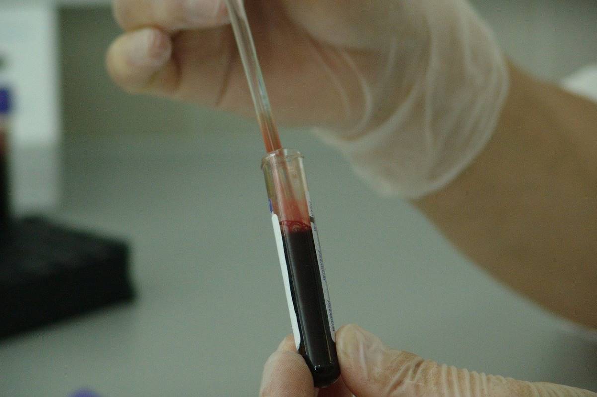TÃ©cnico realizando una prueba de VIH