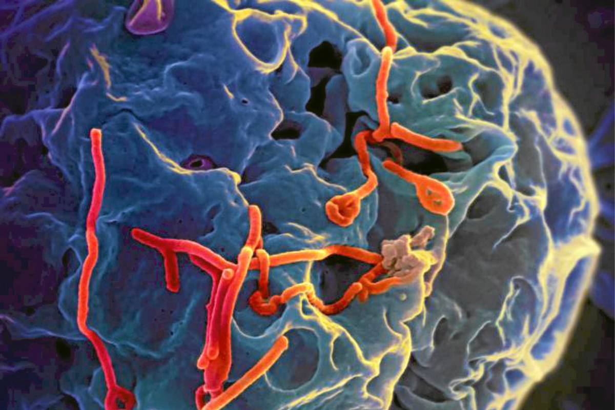 Part�culas del virus del Ébola (en rojo) adheridas a una célula epitelial renal de mono.