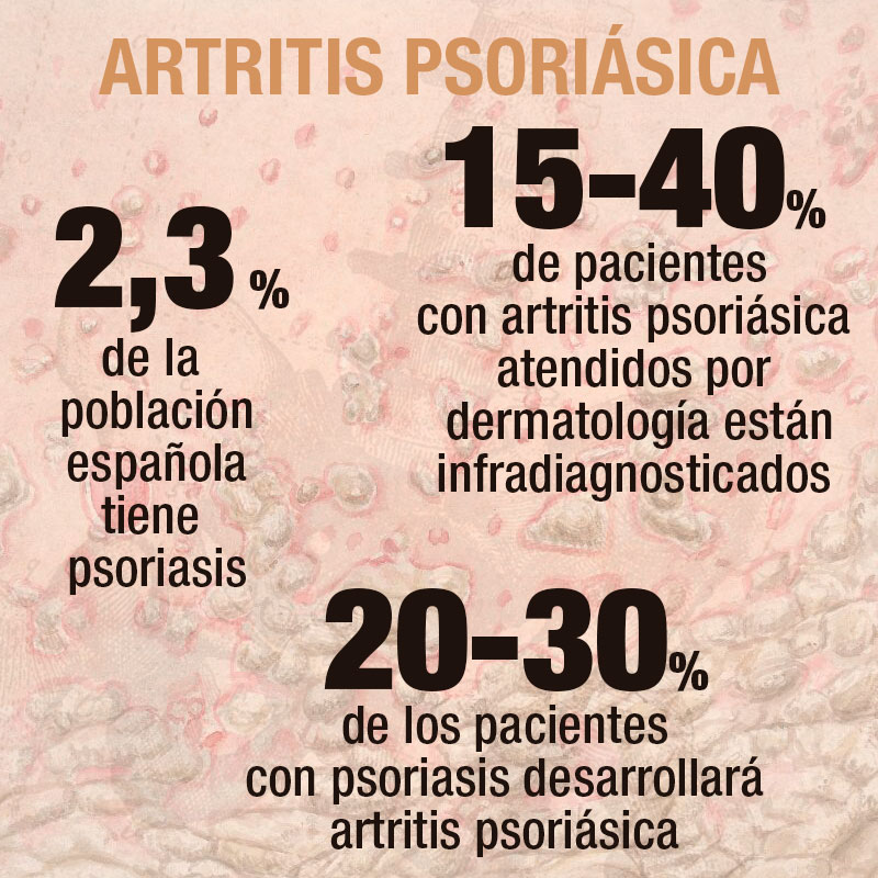 Datos de la artritis psoriásica