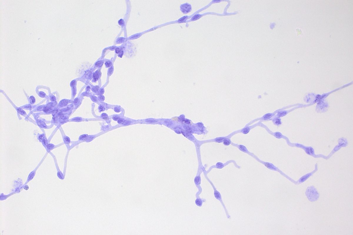 Microvasos de cerebro de ratón, tejido donde disminuye el transportador de tiamina. FOTO: CBMSO-CSIC-UAM