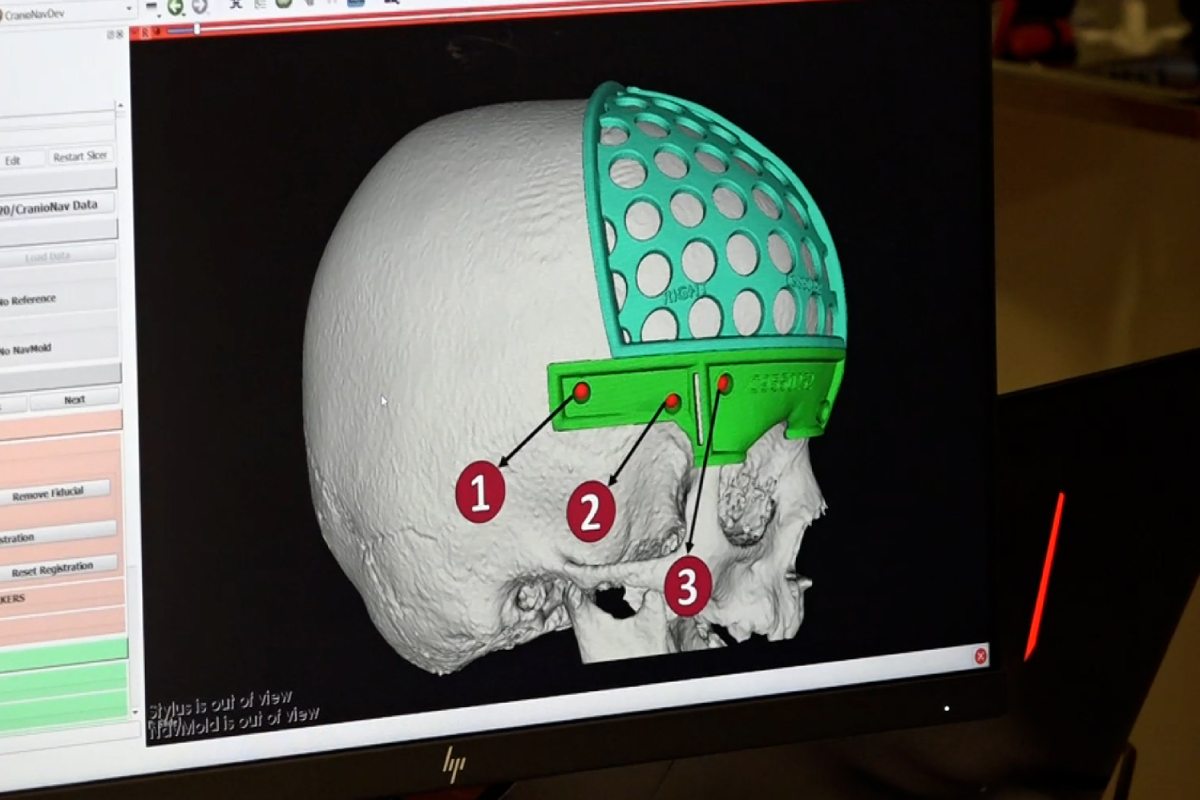PlanificaciÃ³n de la cirugÃa.