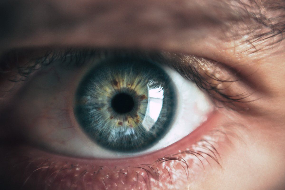 El abordaje de un ojo lesionado no debería restringirse sólo a ese ojo. El tratamiento debería aplicarse en ambos. FOTO: DM. 