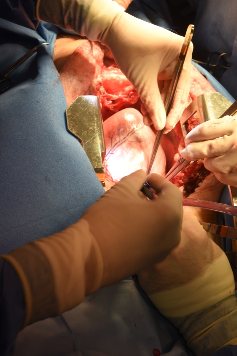 Corazón de cerdo antes de la extracción.