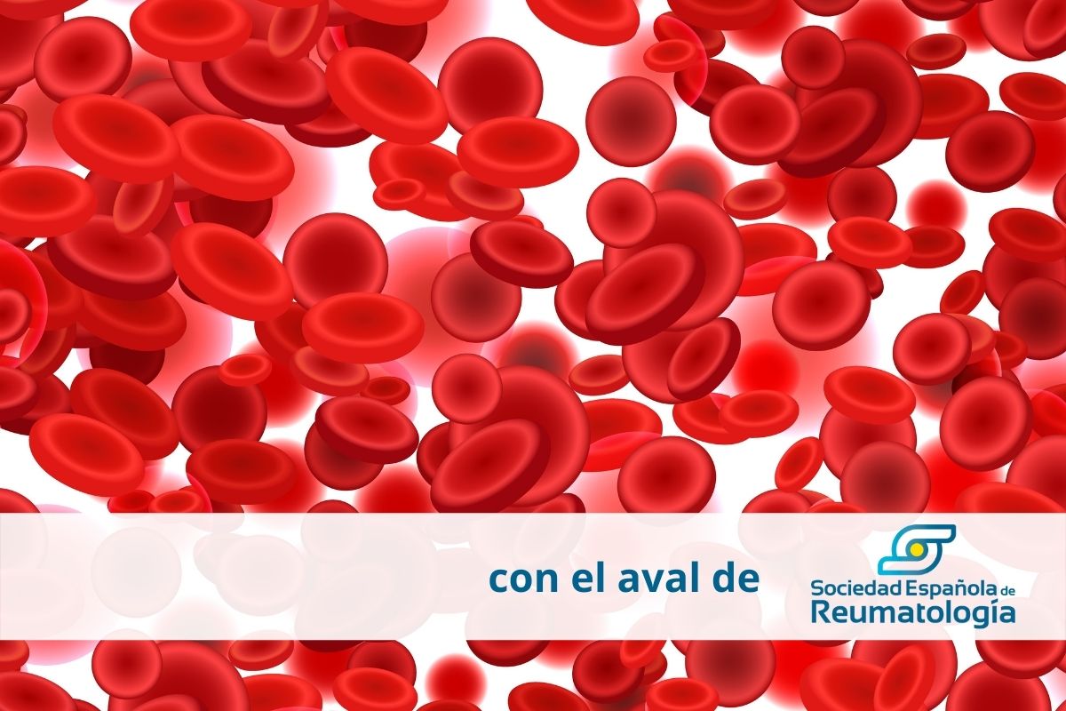 Quiz Vasculitis SER