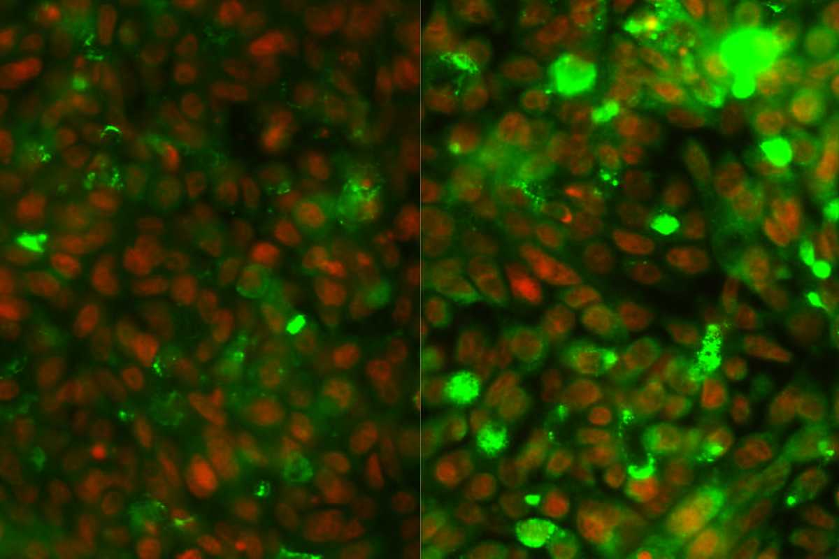 Comparación de células de cáncer colorrectal antes (izquierda) y después (derecha) del tratamiento con fluorouracilo e irinotecano. La expresión de las mucinas se muestra en verde. Crédito: Lluís Espinosa/IMIM