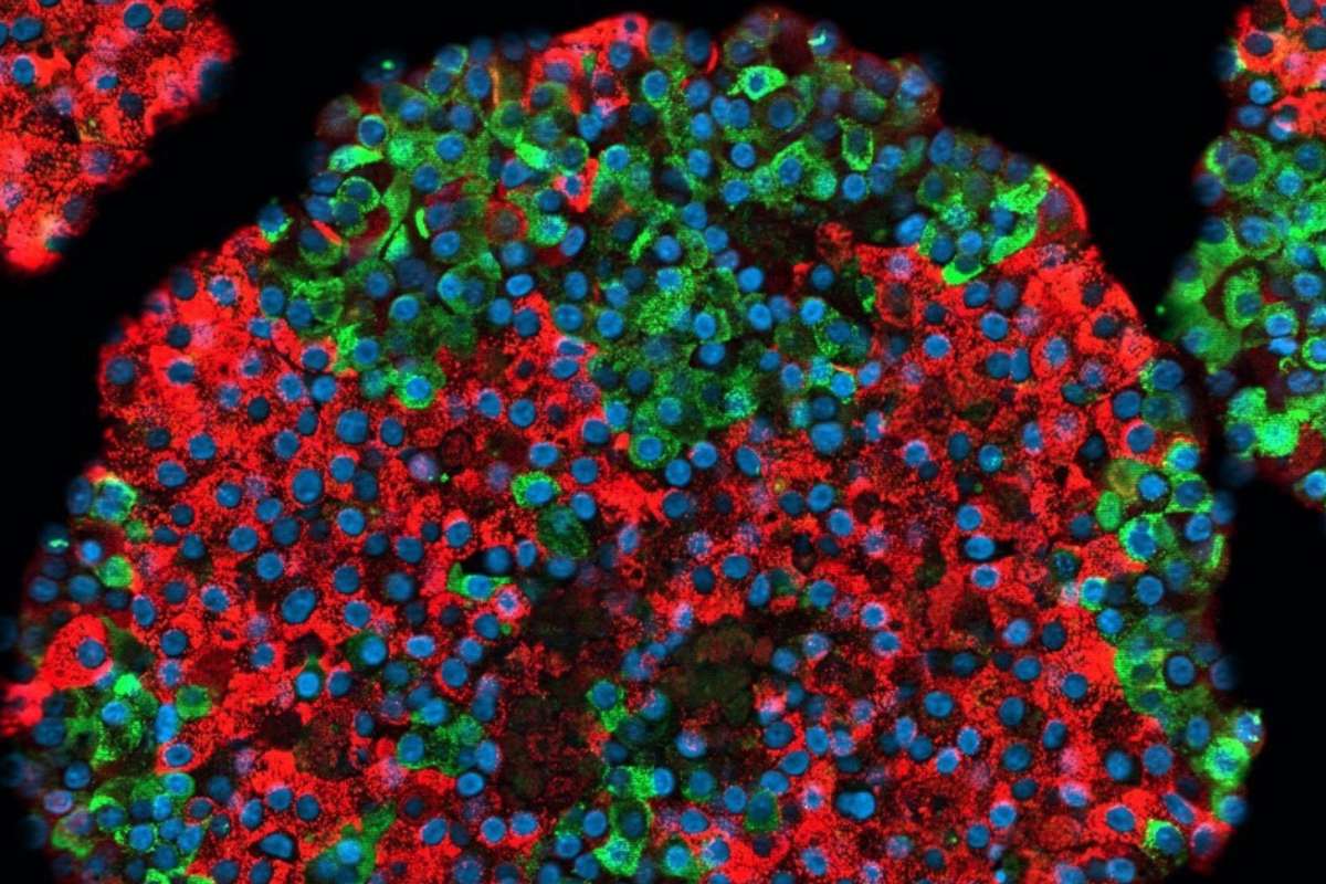 Islote derivado de células madre: células beta que producen insulina marcadas en rojo; células alfa que producen glucagón, en verde. (FOTO: Väinö Lithoviu/Universidad de Helsinki). 