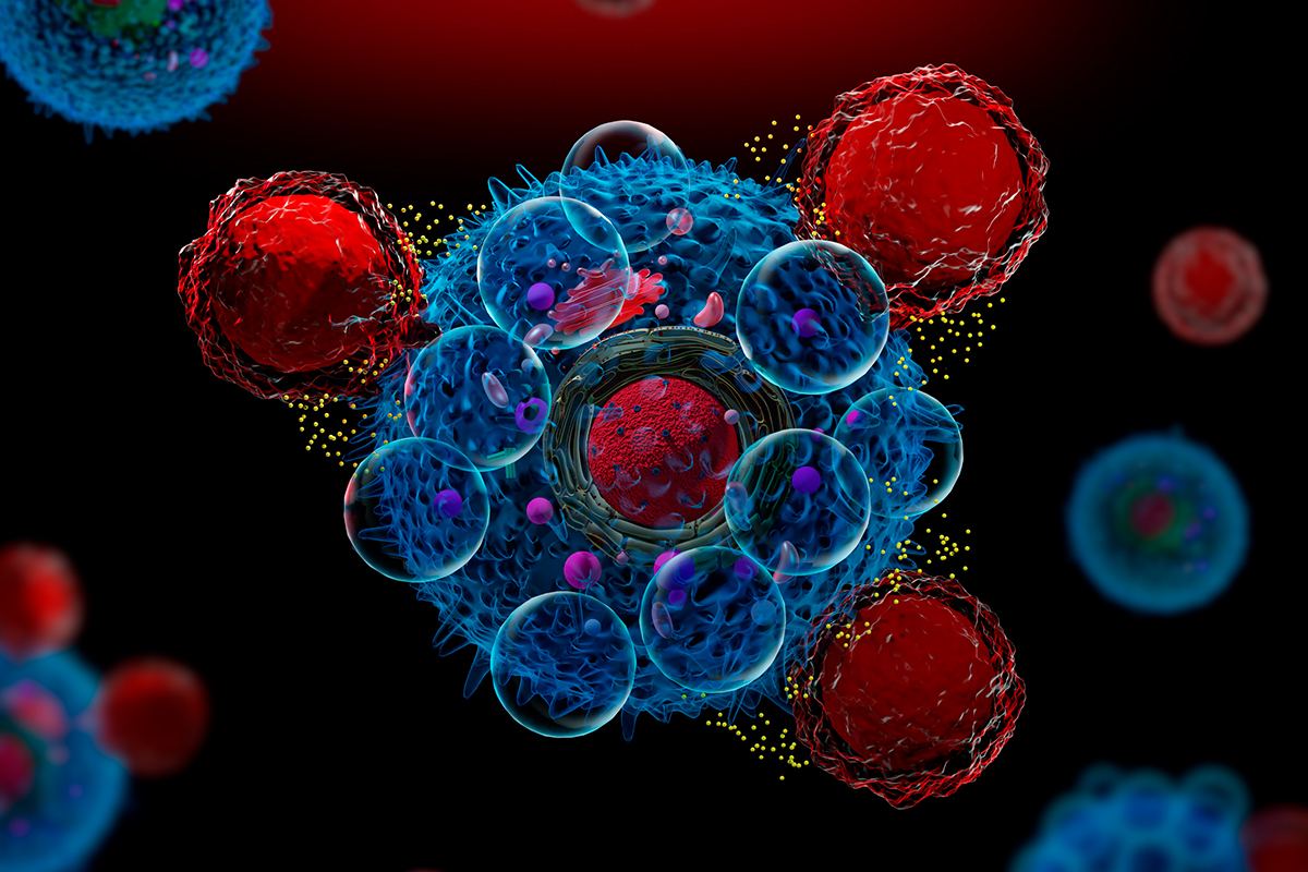 Las terapias CAR-T han supuesto una revolución en el tratamiento de ciertos cánceres de la sangre; las células STAb podrían ser su evolución.