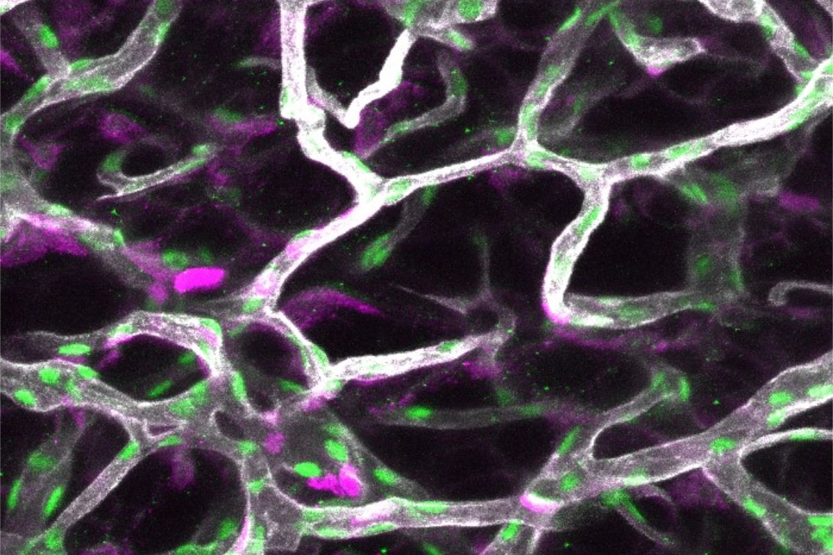 Inmunoflorescencia de tejido adiposo blanco donde se han teñido los vasos sangu�neos en blanco, los núcleos de las células endoteliales en verde y las células que están proliferando en magenta. FOTO: CicBiogune. 