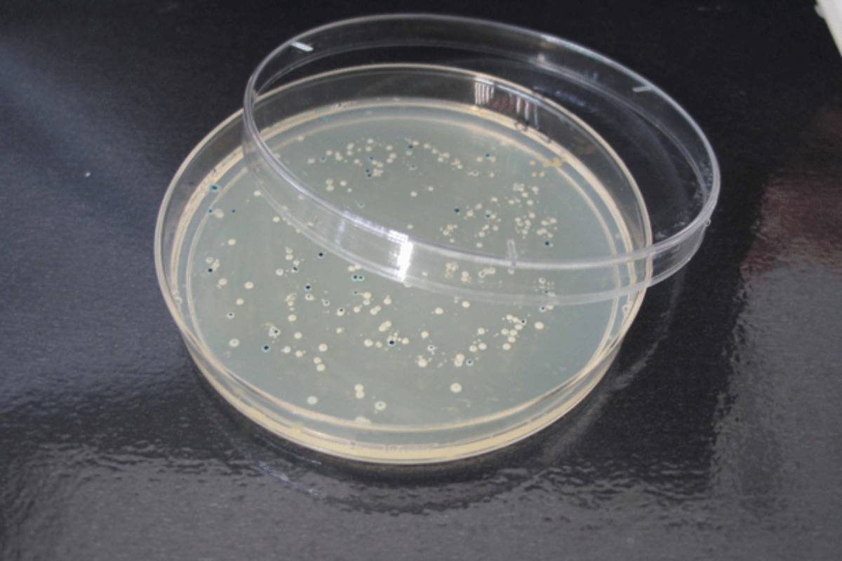 Colonias de bacterias creciendo en una placa de Agar.