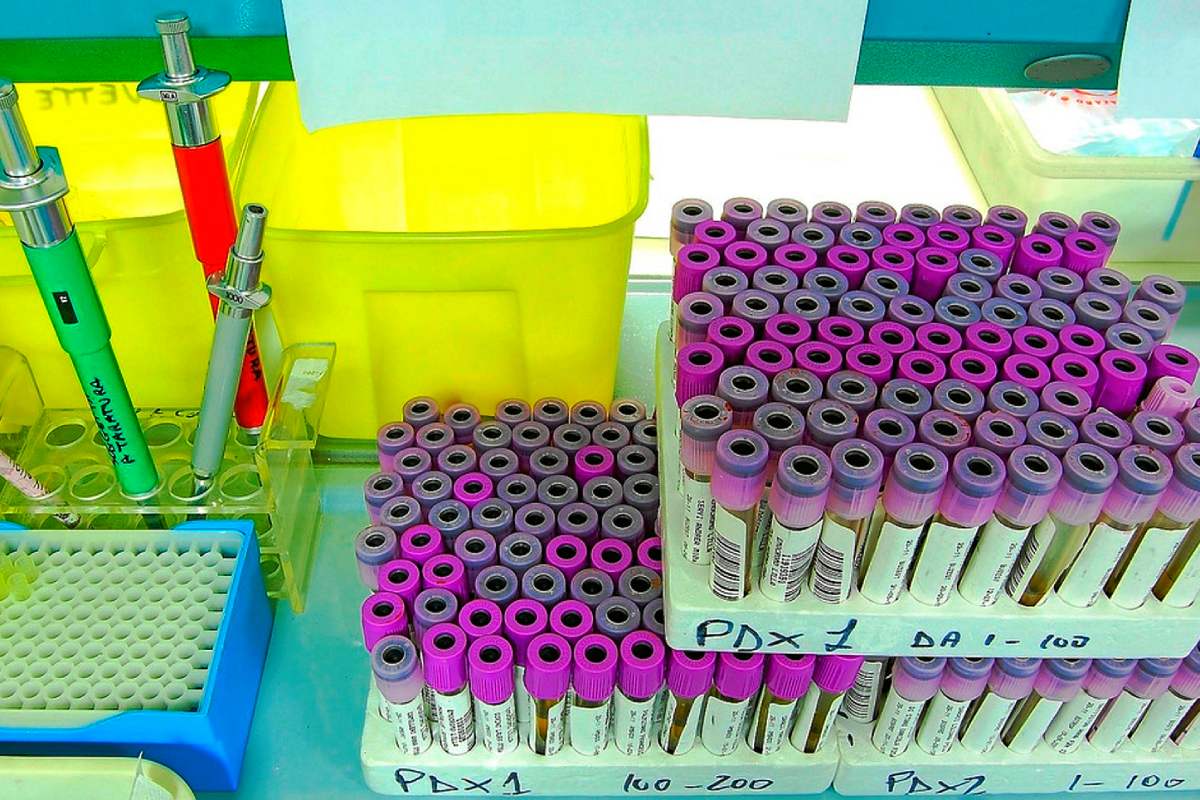 Tubos con muestras de sangre preparados para el análisis. Foto: AGUSTÍN IGLESIAS