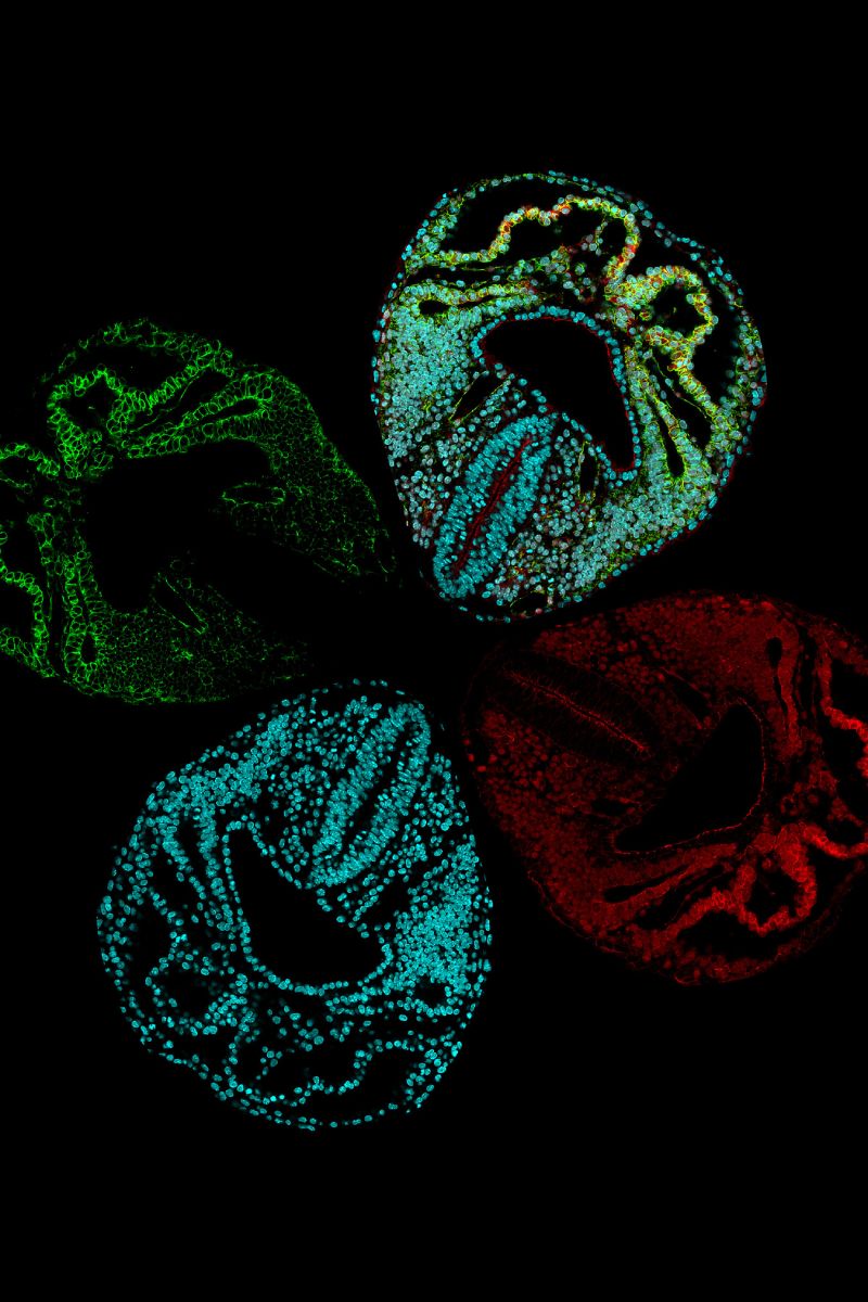 La imagen muestra una sección óptica de una vista ventral de un embrión de ratón en el d�a embrionario E8.0. En verde la membrana de las células mesodérmicas, rojo las células transgénicas positivas de tomate y azul los núcleos. Foto: CNIC. 