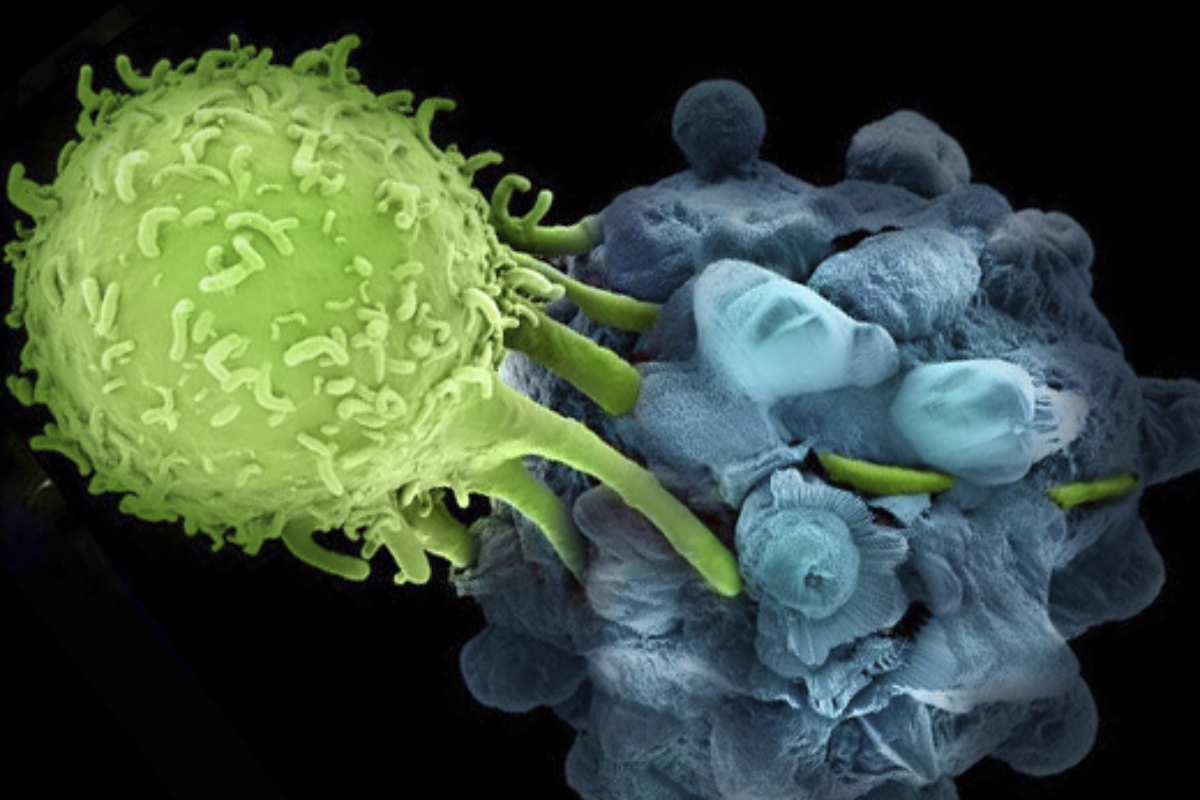 Buscar salidas a la resistencia a inmunoterapias es otro de los grandes logros en oncolog�a. Foto: DM. 
