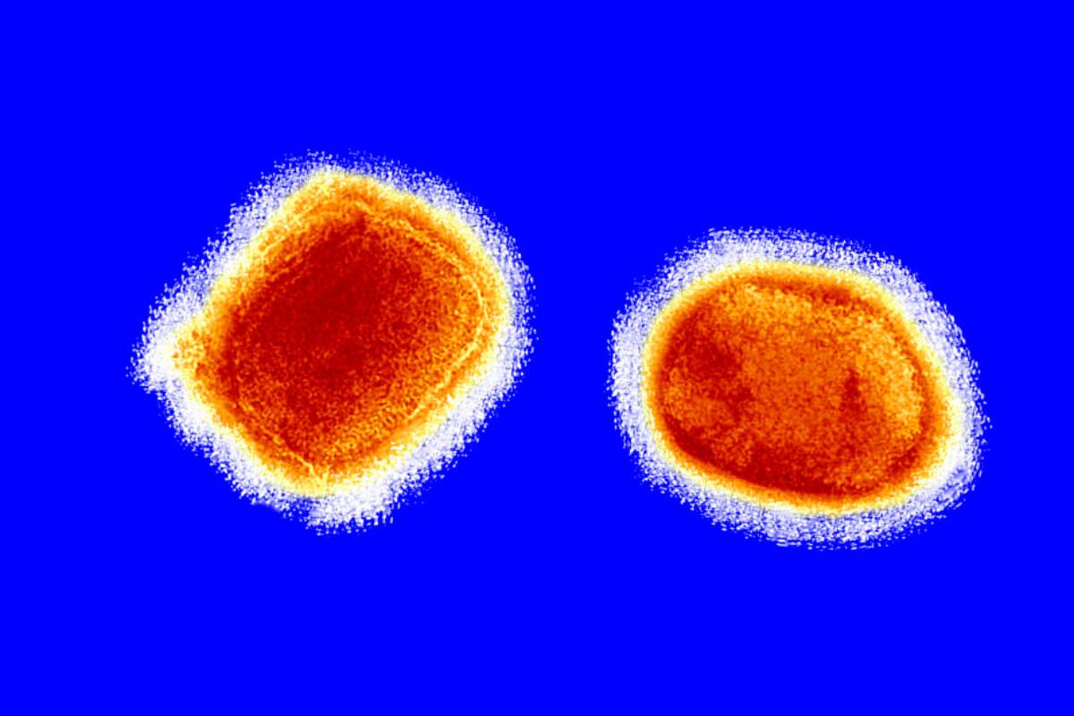 imagen del virus de la viruela del mono. 