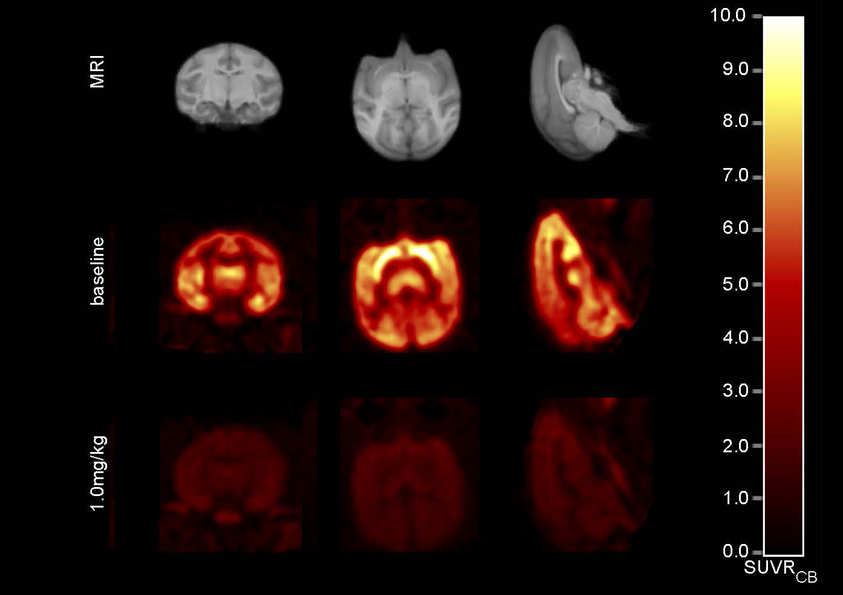 mágenes de MRI y PET de un mono antes (centro) y después de recibir una dosis intravenosa de BMS-984923. Las regiones coloreadas indican áreas de actividad. Foto: STM