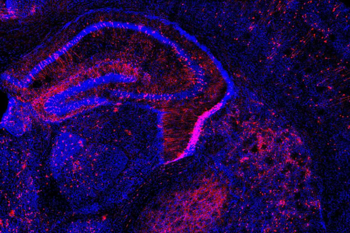 El método 'Pertub-seq' permite introducir cambios, como en esta célula de cerebro murino. Foto: LABORATORIO P. ARLOTTA (HARVARD) 