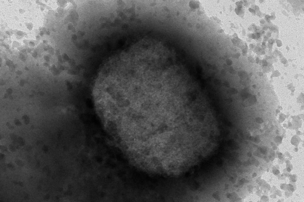 Imagen de microscopia electrónica de virus monkey pox. Foto: DM. 