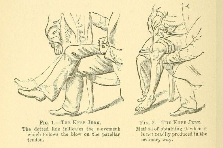 Reflejo rotuliano: al percutir el tendón rotuliano, se contrae el músculo cuádriceps y se produce la extensión de la rodilla. 