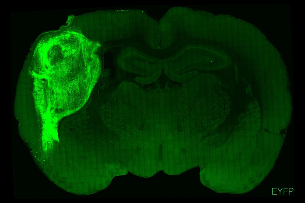 Organoide humano trasplantado en el cerebro de una rata, marcado con proteína fluorescente. Foto: UNIVERSIDAD DE STANFORD 