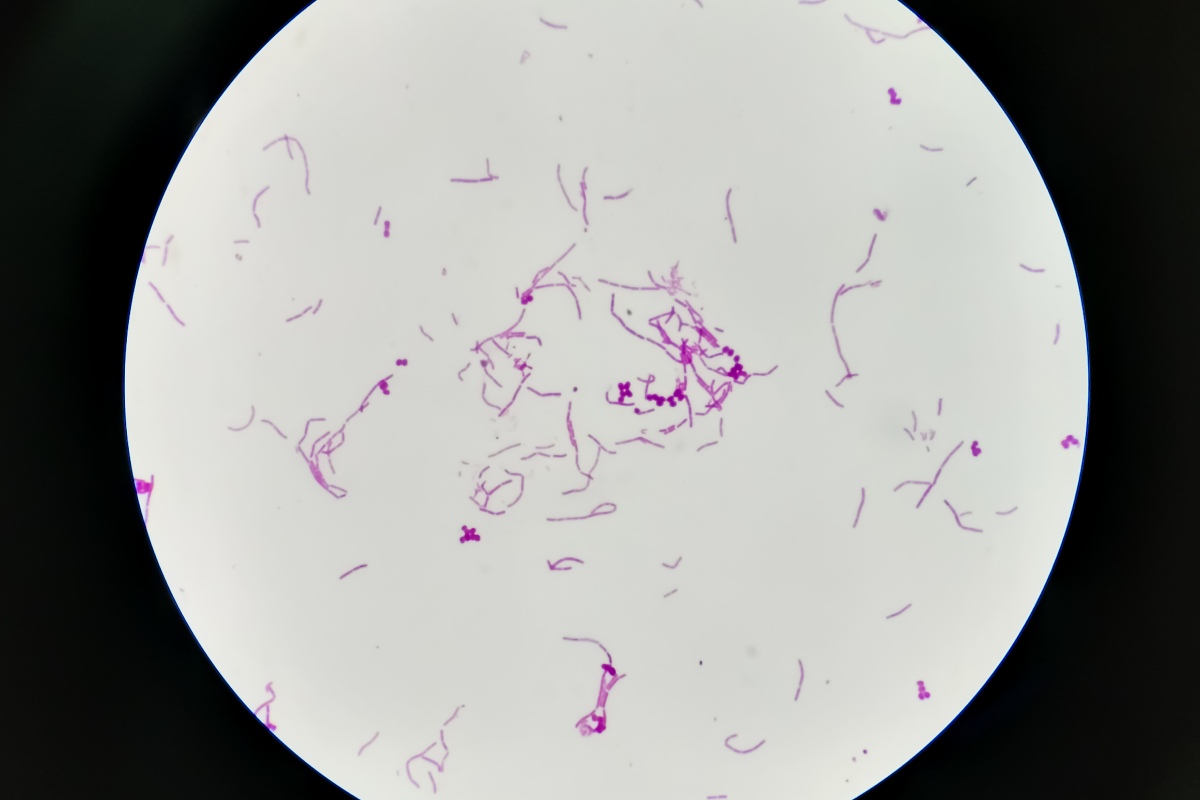 Vista microscópica 100x de las bacterias grampositivas 'Streptococcus', 'S. piogenes', 'S. agalactiae' y otros estreptococos. Foto: SHUTTERSTOCK. 