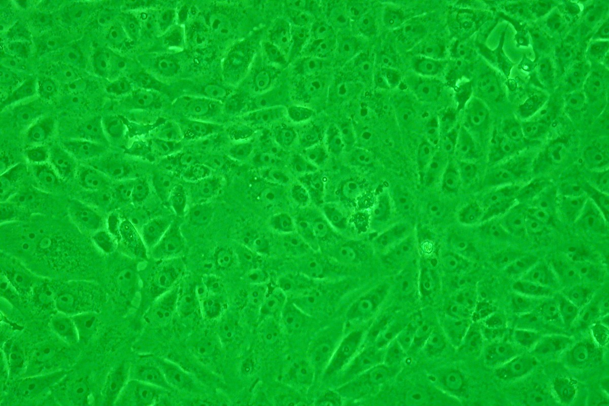 Las células Vero constituyen una de las estirpes celulares continuas de mamífero más empleadas en las investigaciones microbiológicas y de biología molecular y celular. 