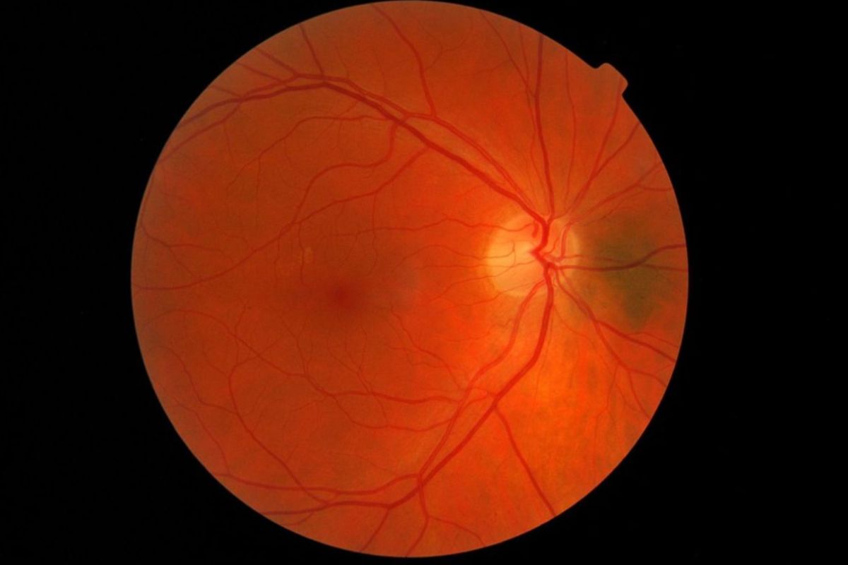Las enfermedades de la retina podrían beneficiarse de las experiencias con terapia génica. Foto: DM. 