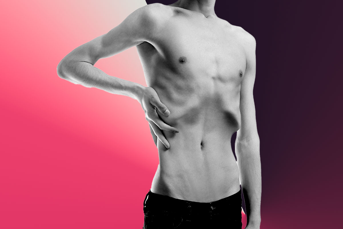 La anorexia nerviosa tiene una incidencia del 1% entre las adolescentes, pero muchas de ellas llegan a la edad adulta con la enfermedad sin curar. Foto: SHUTTERSTOCK/L. ESPARZA. 