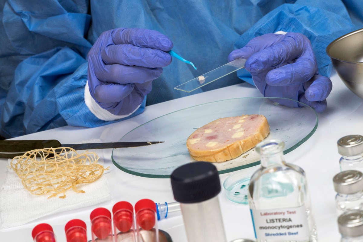 Análisis en laboratorio de una carne rellena contaminada por la bacteria de la listeria. Foto: SHUTTERSTOCK.