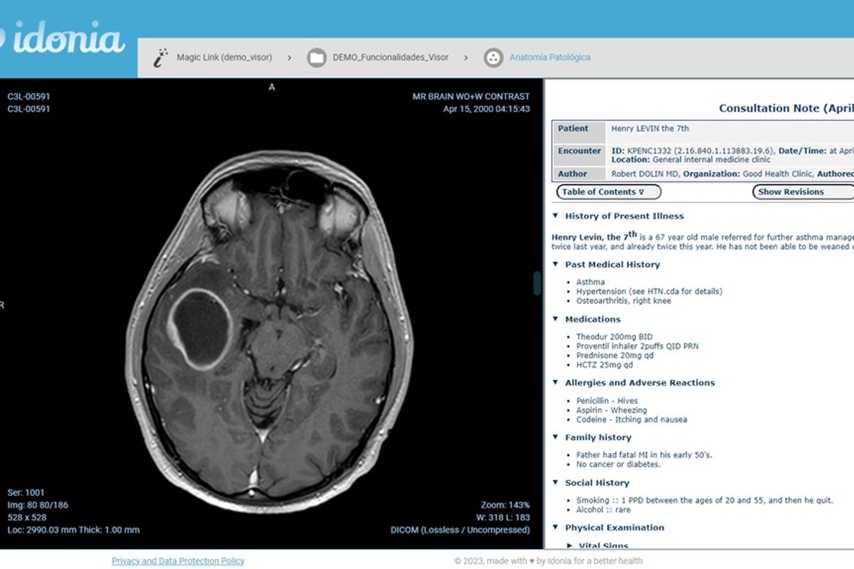 La plataforma de Idonia puede almacenar todo tipo de imágenes e informes de los pacientes. 