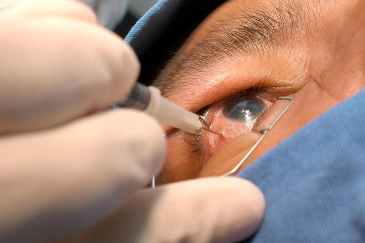 La Aemps debe indemnizar con 25.000 euros a una paciente que se quedó ciega de un ojo tras ser intervenida con el producto sanitario 'Ala Octa'. Foto: DM 
