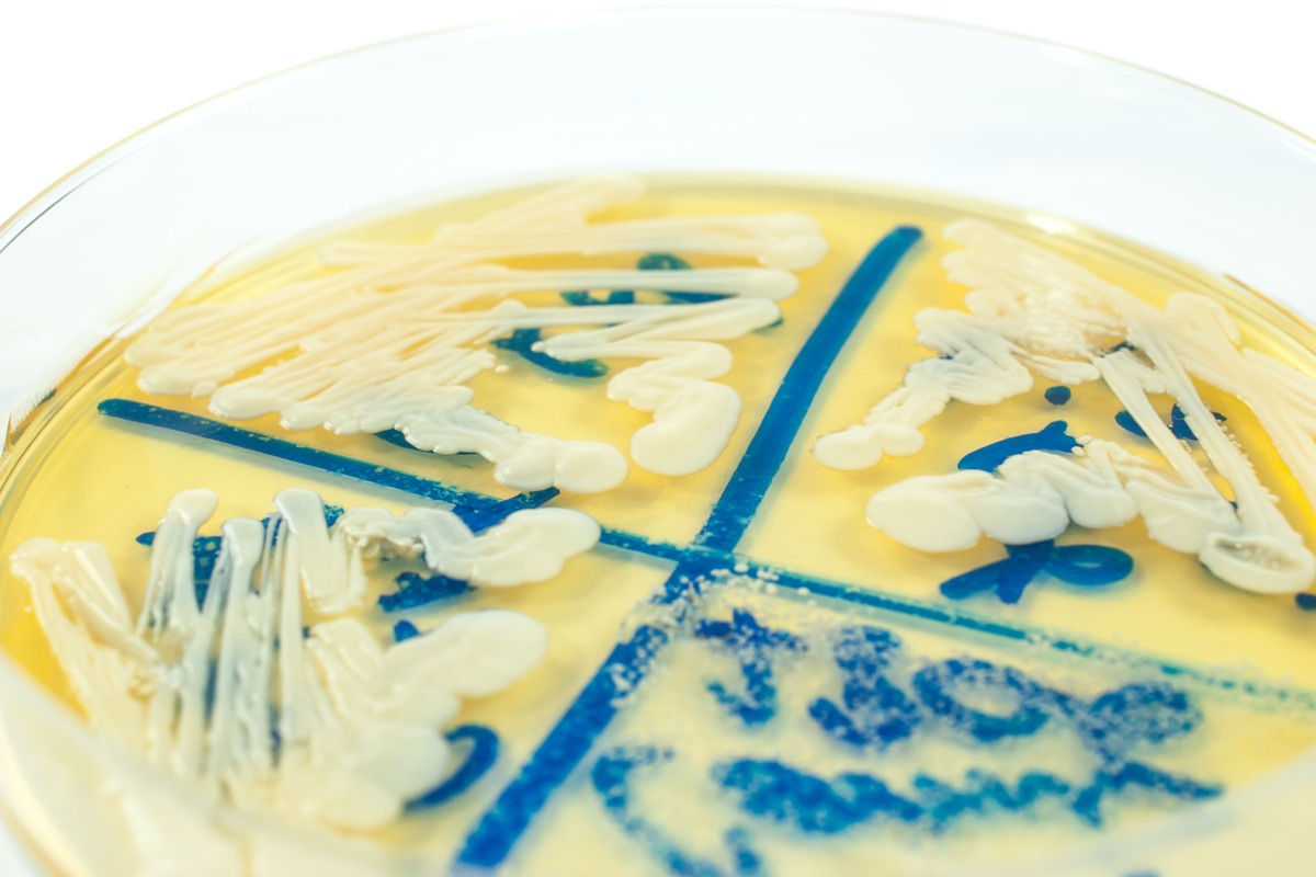 El hongo 'Candida parapsilosis' en una placa de Petri. Foto: SHUTTERSTOCK. 