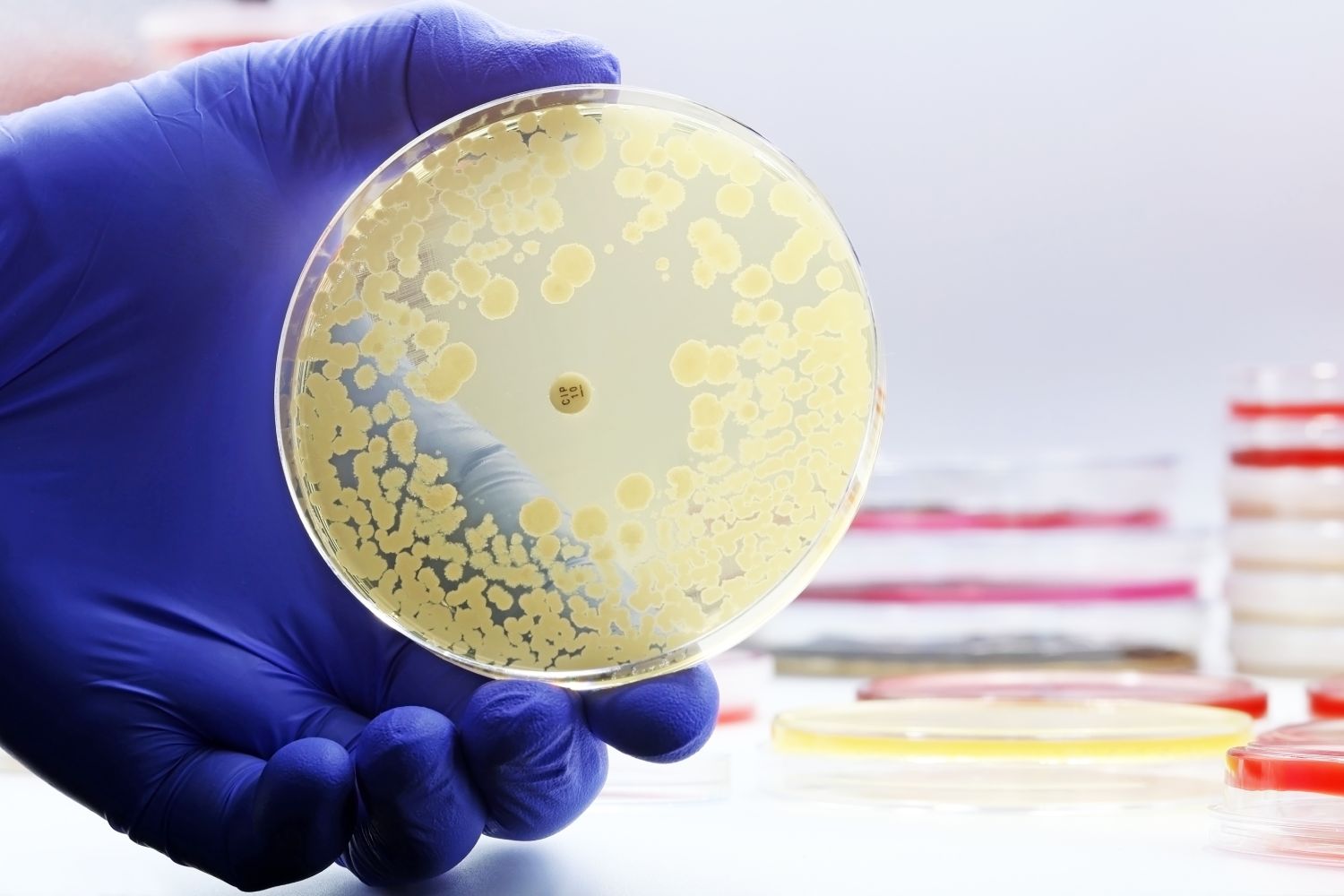 Los gérmenes resistentes a antimicrobianos suponen un importante riesgo para la salud humana. Foto. SUTTERSTOCK. 