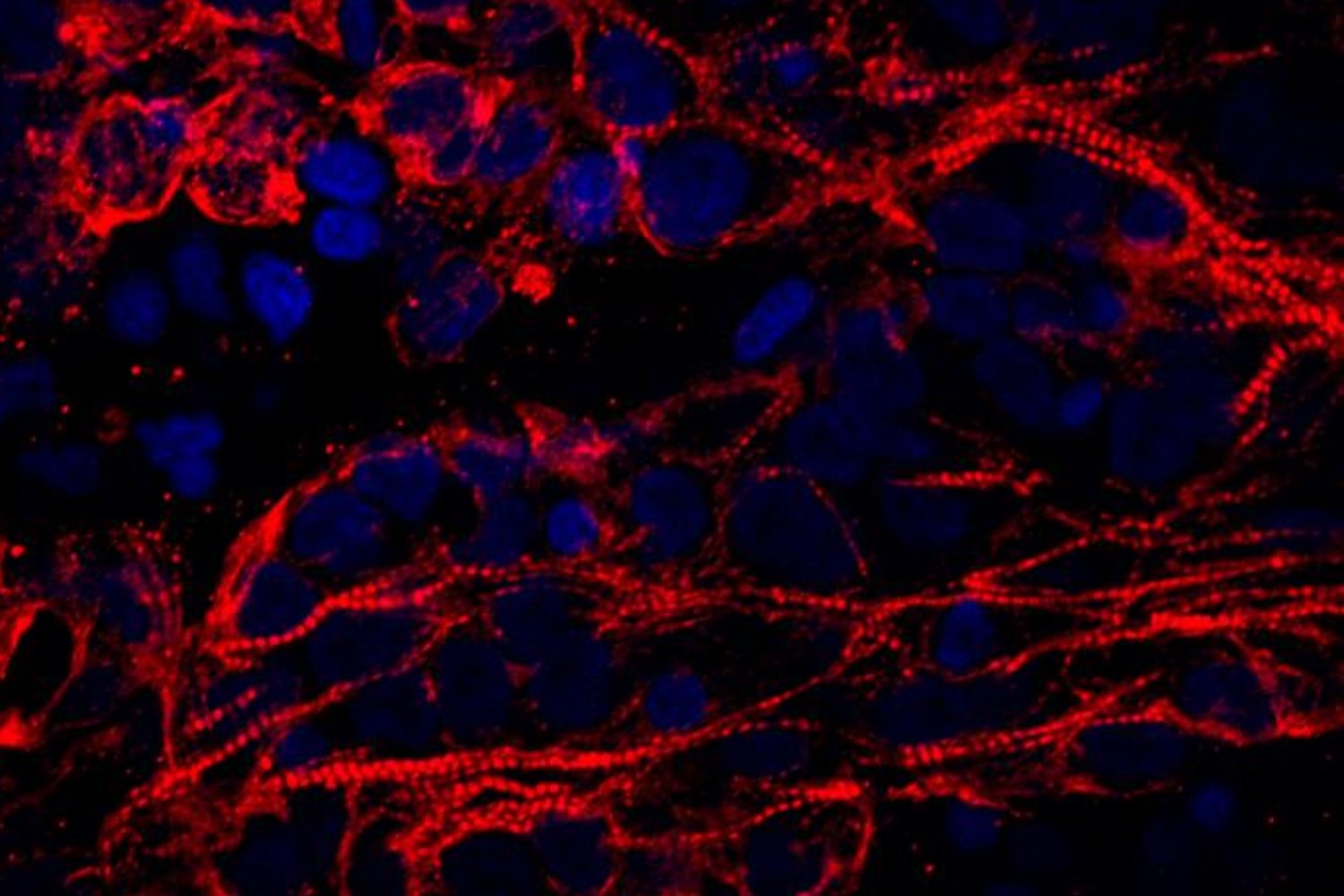 Amplificación del cardiomicitos en el tejido miocárdico de un organoide (las células, en rojo; los núcleos celulares, en azul). Foto: A. KOSTINA/’Stem Cell Reports’. 
