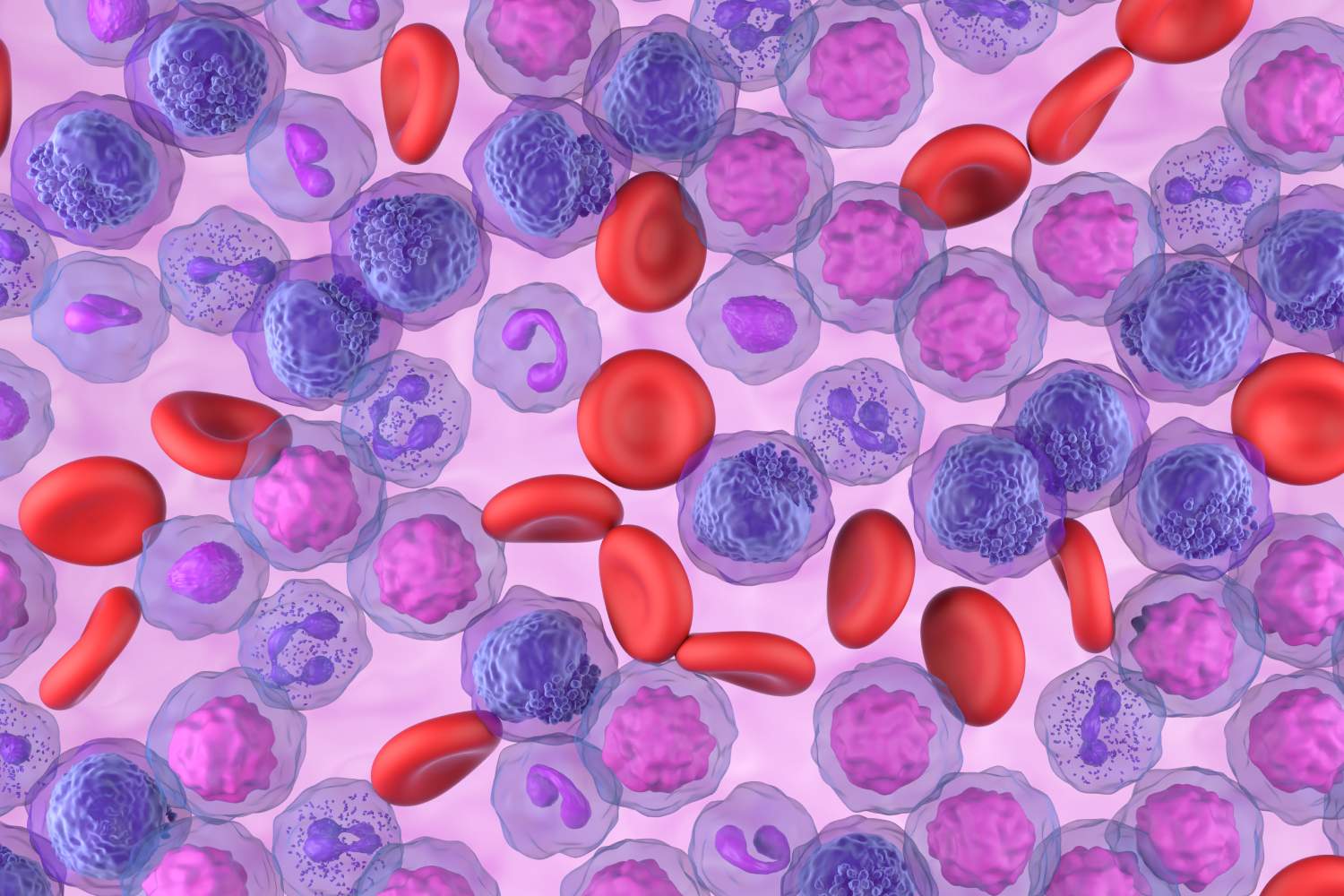Ilustración de leucemia mieloide aguda (LMA). Foto: SHUTTERSTOCK. 