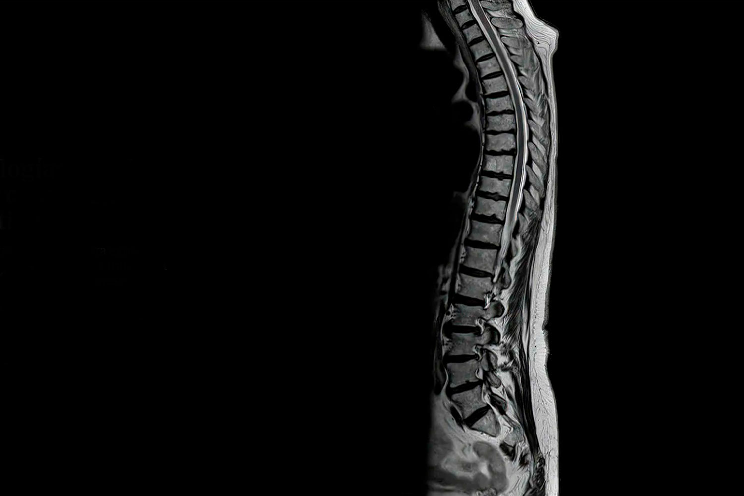 Corte sagital de la espina dorsal completa, obtenida solo en un minuto y 22 segundos. Foto: SIEMENS HEALTHINEERS 