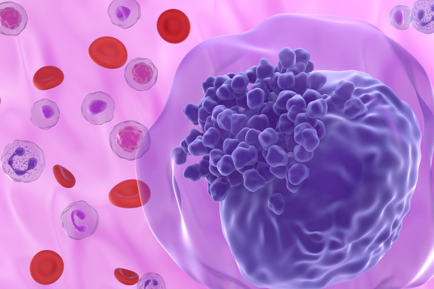 La leucemia es una de los cánceres sanguíneos más frecuentes. Foto: SHUTTERSTOCK. 