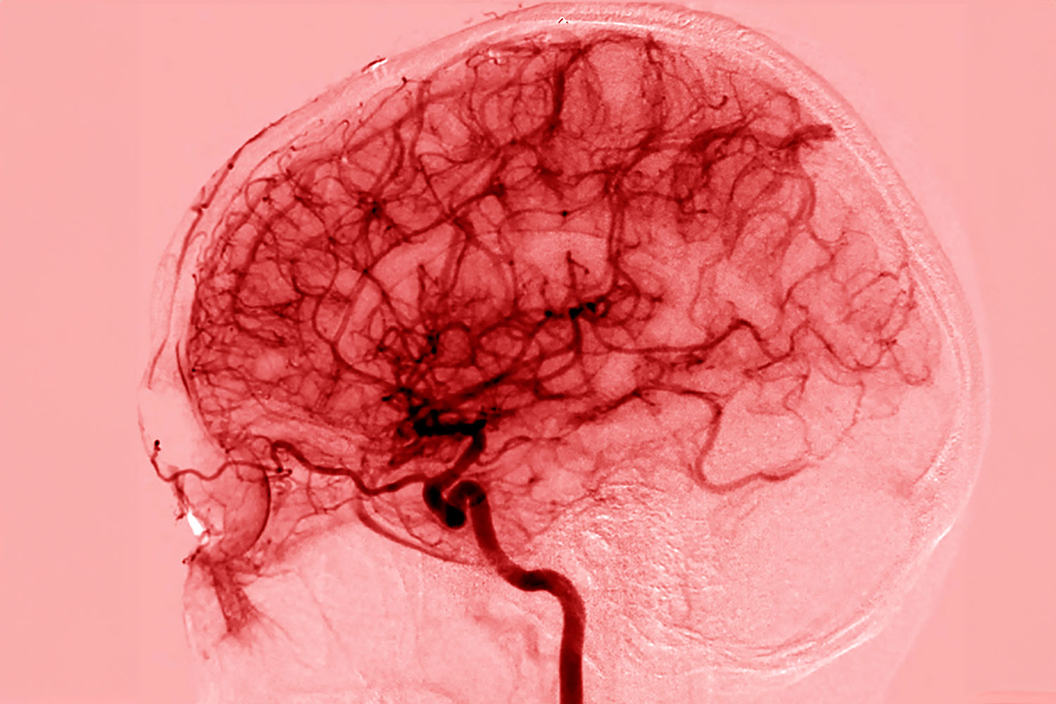 Imagen de la vasculatura encefálica 