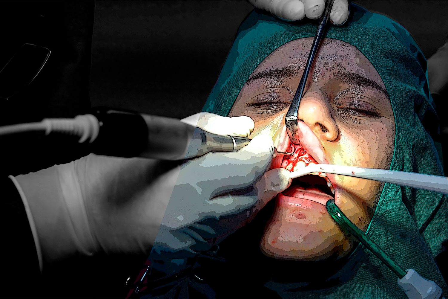 Cirugía Oral y Maxilofacial es la tercera especialidad MIR que agota sus plazas de formación. Foto: LOURDES ESPARZA. 