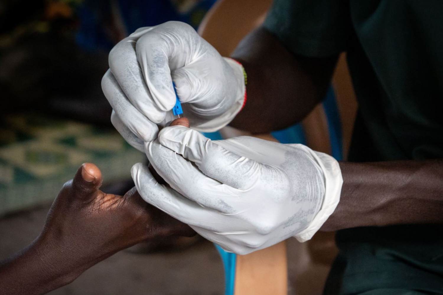 Recogida de muestras de sangre para realizar un test rápido de detección de Malaria. Foto: MSF 
