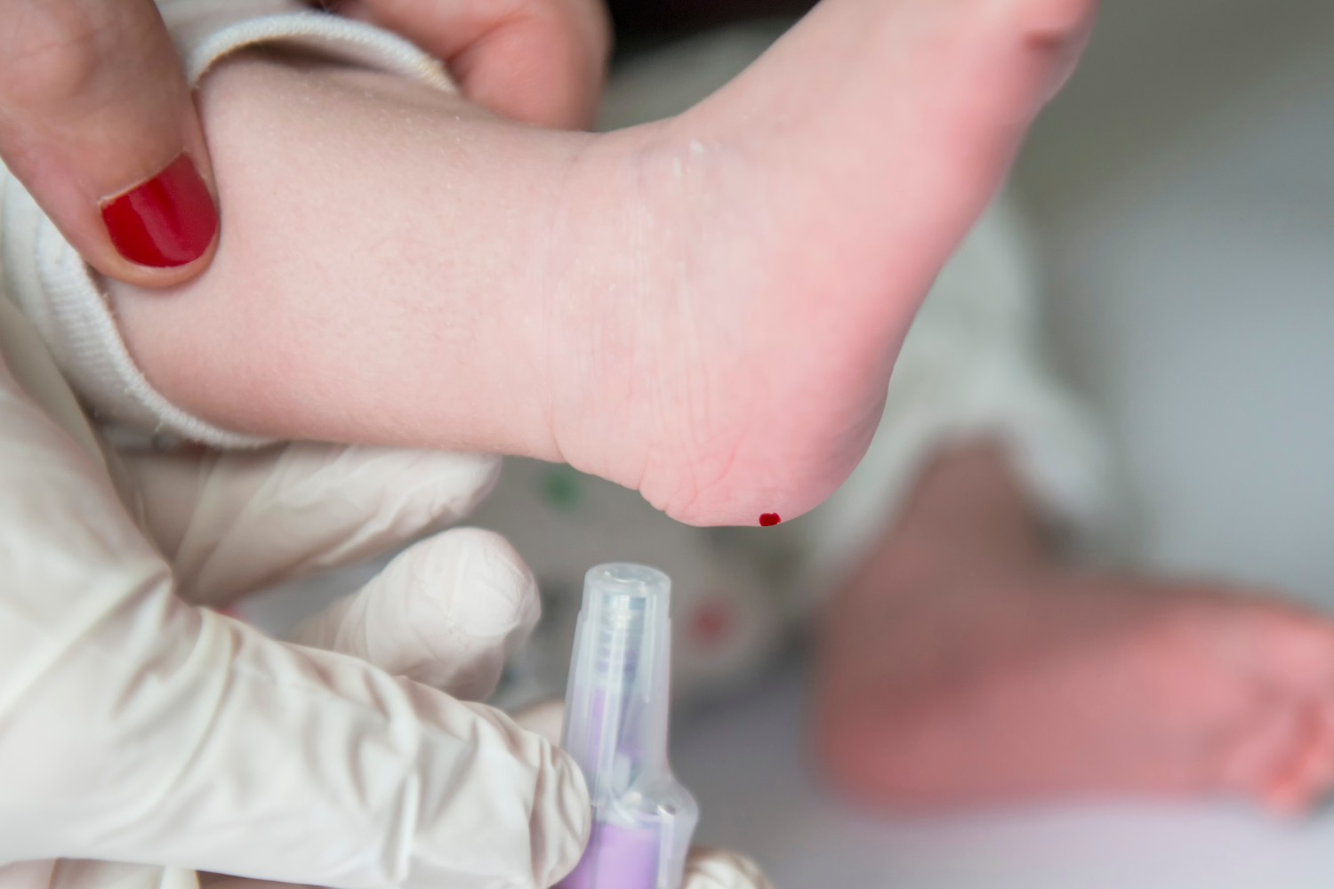 La prueba del talón en recién nacidos es fundamental para la detección de distintas enfermedades. Foto: SHUTTERSTOCK. 