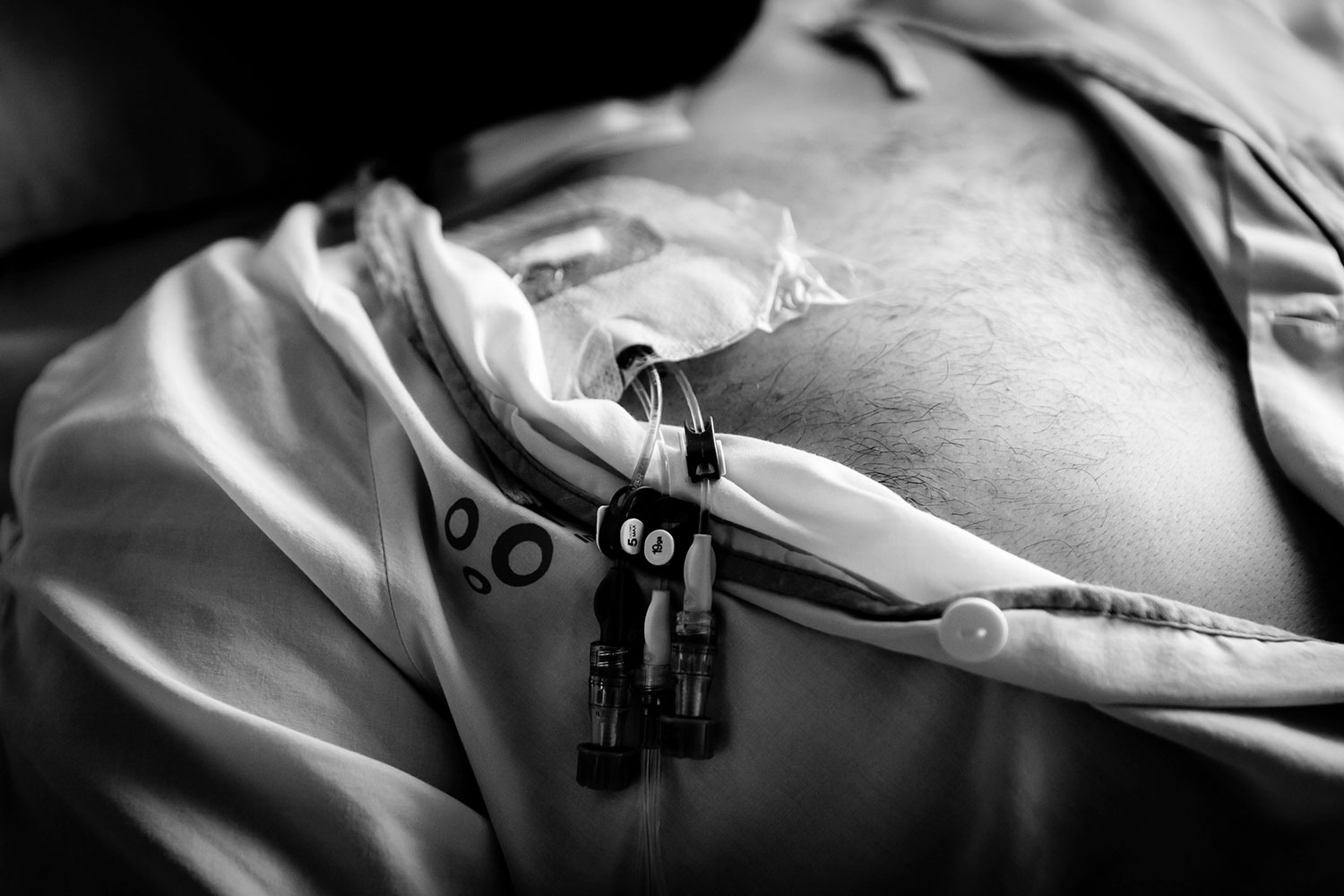 Paciente tratado con células CAR-T. Foto: SONIA TRONCOSO. 