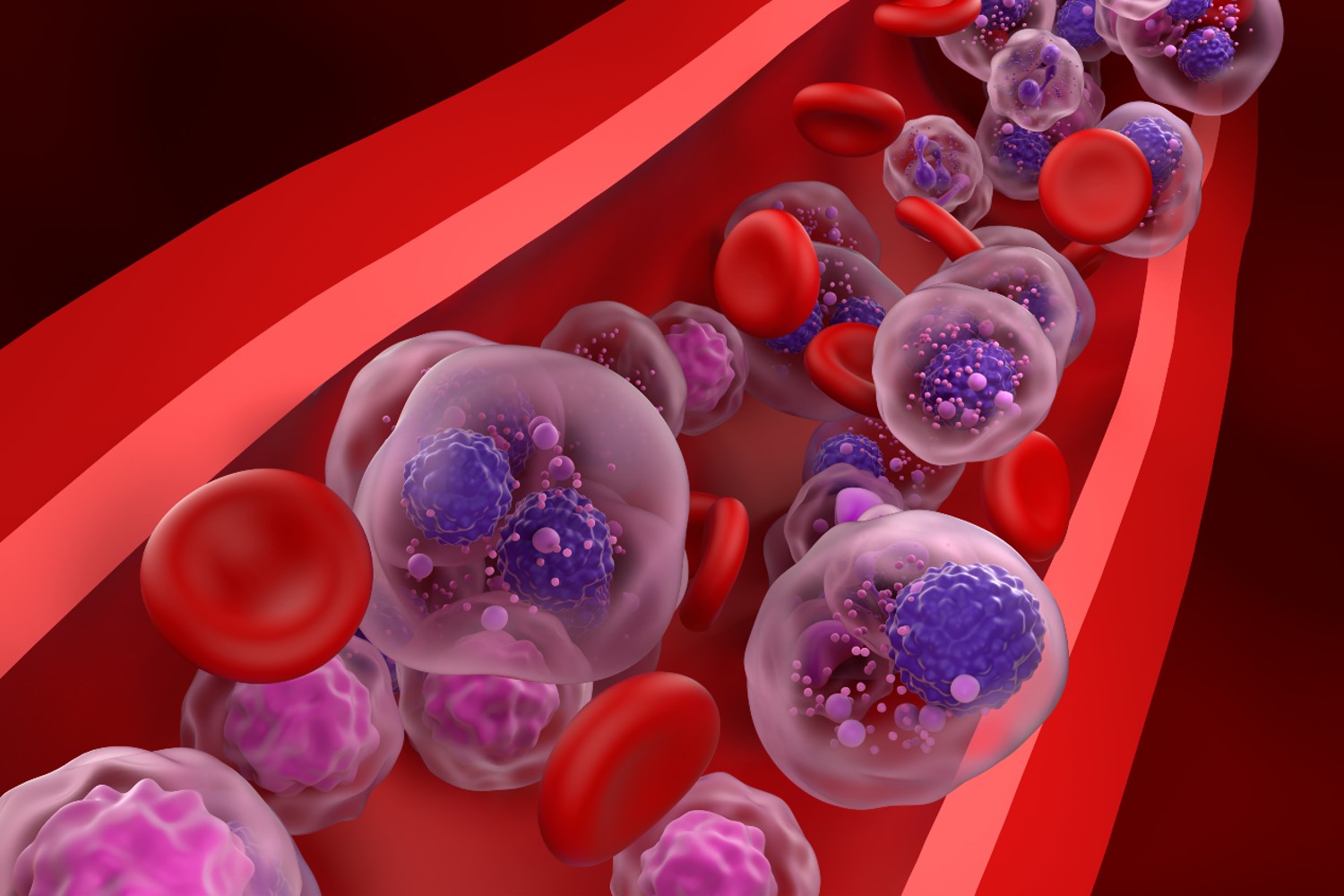 Múltiples células de mieloma múltiple en el flujo sanguíneo. Foto: SHUTTERSTOCK. 