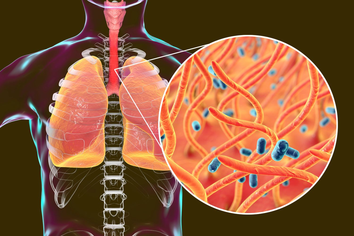Los patógenos de 'Bordetella pertussis' invaden el aparato respiratorio. Imagen: SHUTTERSTOCK. 