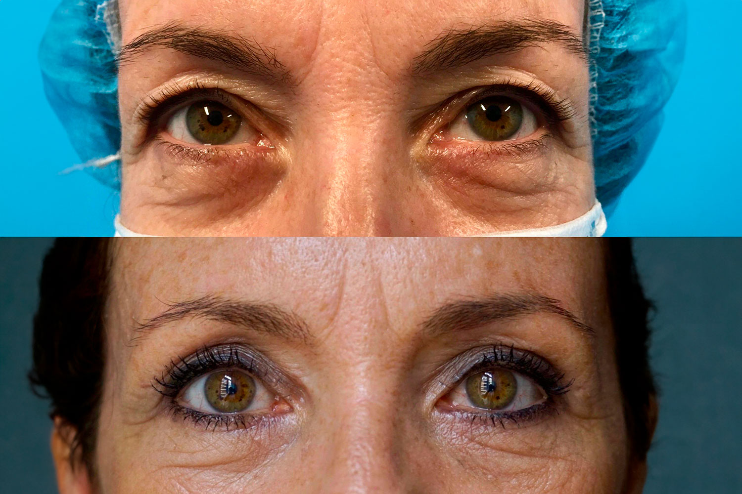 Imagen con el antes (arriba) y el después (abajo) de la reparación. Foto: CLÍNICA RIBERA MESTALLA. 