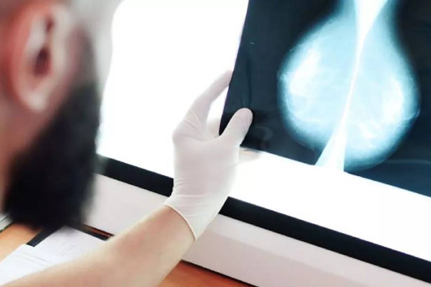 La Fiscalía archiva dos últimas causas por los cribados de cáncer en Andalucía